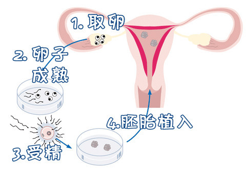 高龄二胎